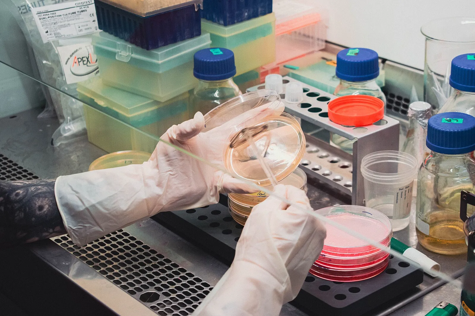 Bakterieodling i mikrobiologiskt laboratorium