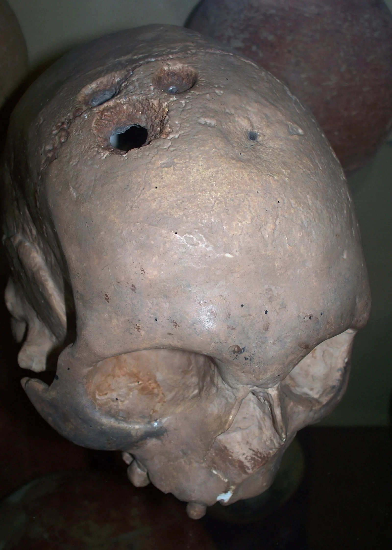 En trepanerad skalle från bronsåldern i museimiljö, arkivbild